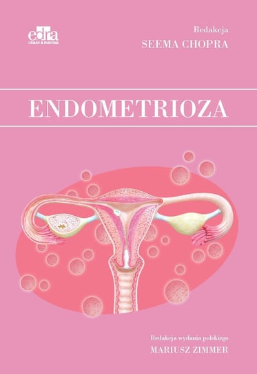 Endometrioza Opracowanie zbiorowe