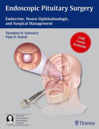 Endoscopic Pituitary Surgery: Endocrine, Neuro-Ophthalmologic, and Surgical Management [With 3-D Glasses] Thieme Medical Publ Inc., Thieme Medical Publishers Inc.