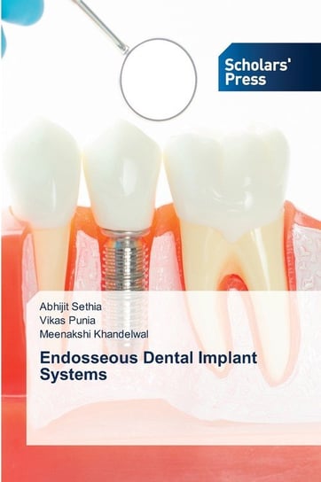 Endosseous Dental Implant Systems Sethia Abhijit