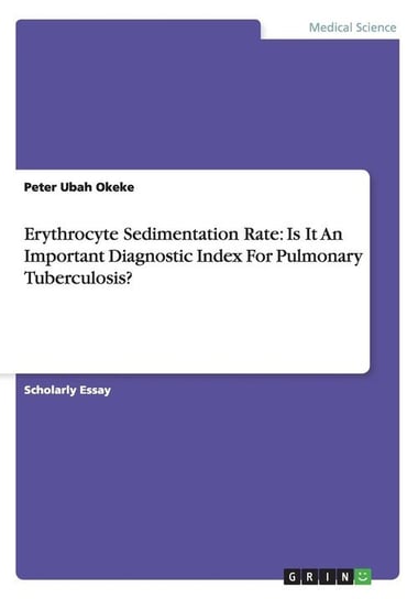 Erythrocyte Sedimentation Rate Okeke Peter      Ubah