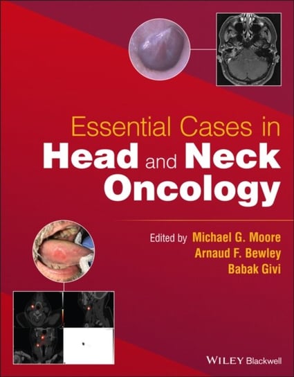 Essential Cases in Head and Neck Oncology B. Givi