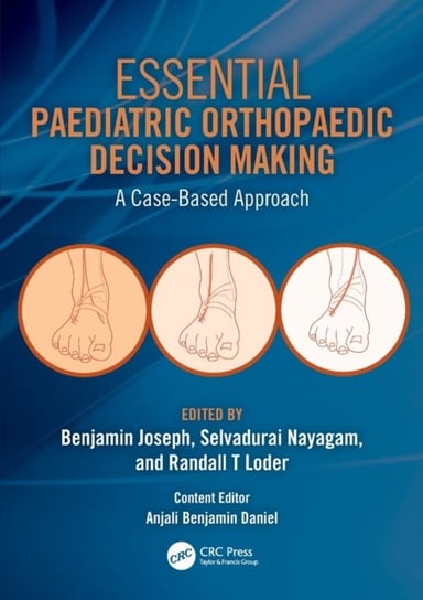 Essential Paediatric Orthopaedic Decision Making. A Case-Based Approach Opracowanie zbiorowe