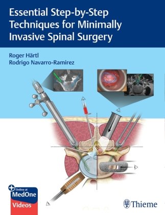 Essential Step-by-Step Techniques for Minimally Invasive Spinal Surgery Thieme, Stuttgart