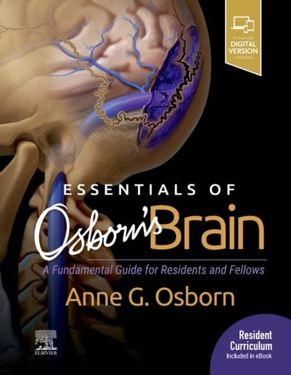 Essentials of Osborns Brain A Fundamental Guide for Residents and Fellows Anne G. Osborn