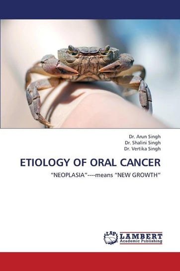 Etiology of Oral Cancer Singh Arun