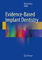 Evidence-Based Implant Dentistry Springer-Verlag Gmbh, Springer International Publishing Ag