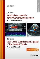 Farbduplexsonografie der hirnversorgenden Gefäße / Color-Coded Duplex Ultrasonography of the Cerebral Vessels Bartels Eva