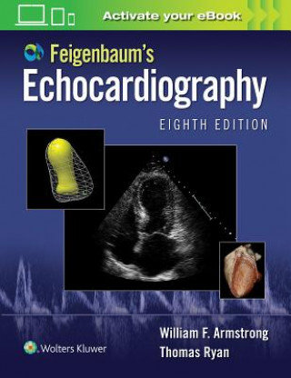 Feigenbaum's Echocardiography Armstrong William F.