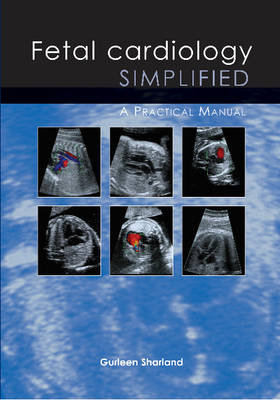Fetal Cardiology Simplified Gurleen Sharland
