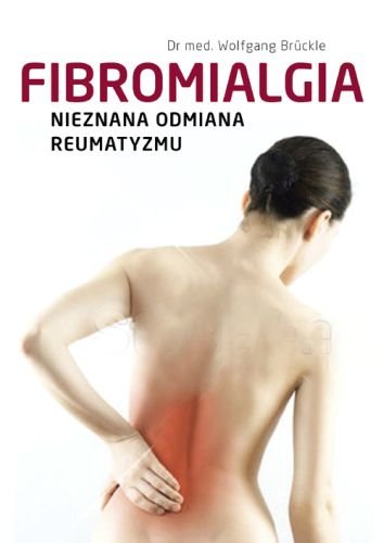 Fibromialgia. Nieznana odmiana reumatyzmu Bruckle Wolfgang