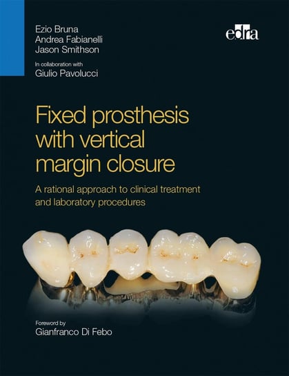 Fixed prosthesis with vertical margin closure Jason Smithson, Andrea Fabianelli, Bruna Ezio