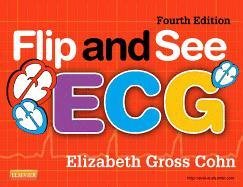 Flip and See ECG Cohn Elizabeth Gross