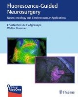 Fluorescence-Guided Neurosurgery Hadjipanayis Constantinos G., Stummer Walter
