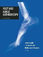 Foot and Ankle Arthroscopy Springer New York, Springer Us