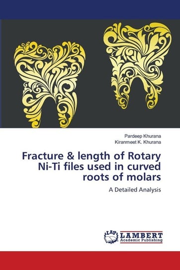 Fracture & length of Rotary Ni-Ti files used in curved roots of molars Khurana Pardeep