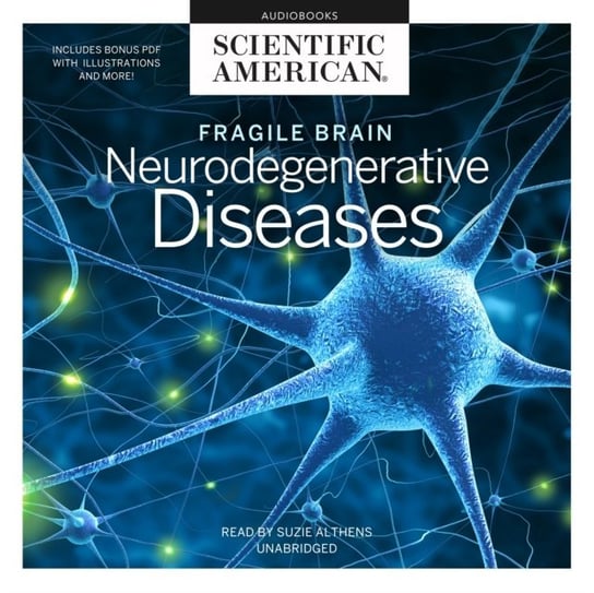 Fragile Brain American Scientific