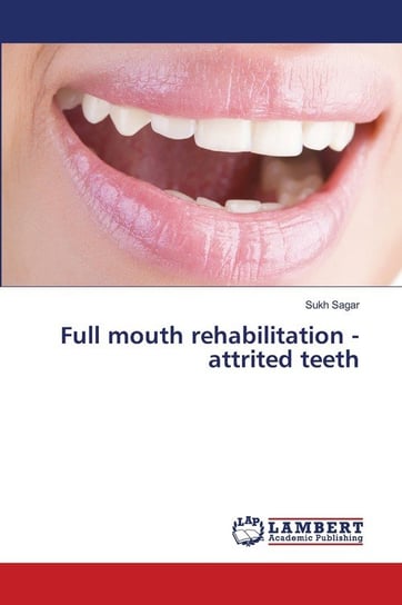 Full mouth rehabilitation - attrited teeth Sukh Sagar