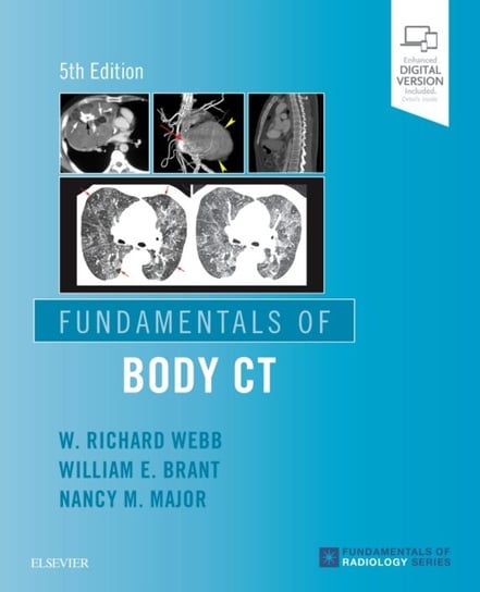 Fundamentals of Body CT Opracowanie zbiorowe