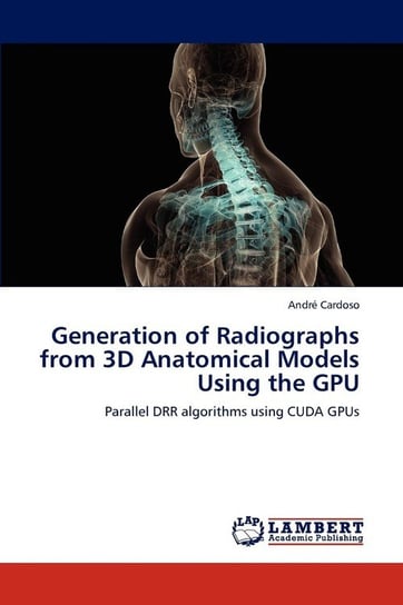 Generation of Radiographs from 3D Anatomical Models Using the GPU Cardoso André