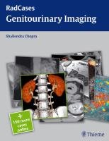 Genitourinary Imaging Chopra Shailendra