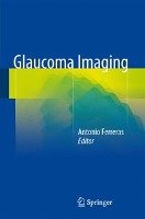 Glaucoma Imaging Springer-Verlag Gmbh, Springer International Publishing