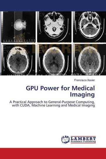 GPU Power for Medical Imaging Xavier Francisco