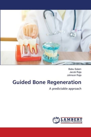 Guided Bone Regeneration Salam Babu