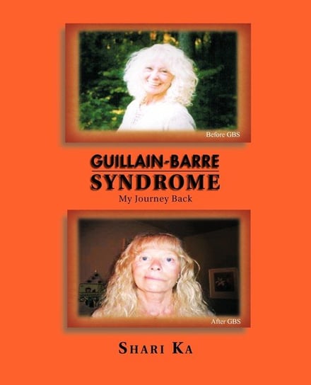 Guillain-Barre Syndrome Shari Ka