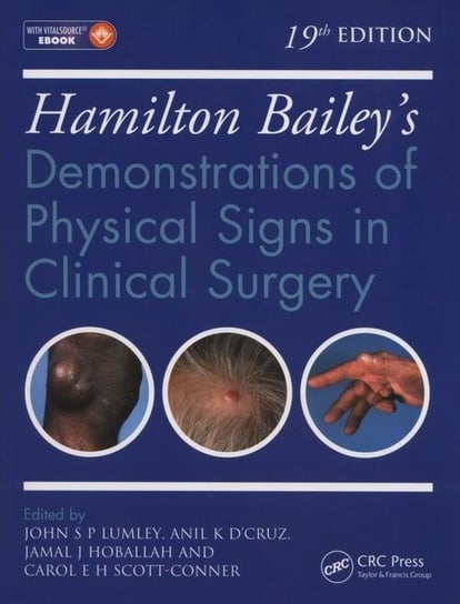 Hamilton Bailey's Physical Signs. Demonstrations of Physical Signs in Clinical Surgery Hoballah Jamal J., Lumley John S.P.