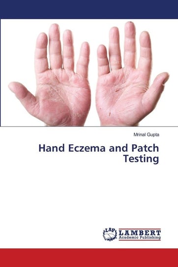 Hand Eczema and Patch Testing Gupta Mrinal