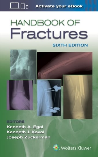 Handbook of Fractures, Lippincott Raven