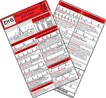 Herzrhythmusstörungen - Medizinische Taschen-Karte Hawelka Verlag, Hawelka Uwe