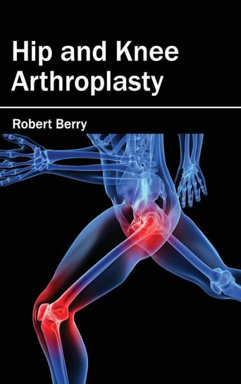 Hip and Knee Arthroplasty M L Books International