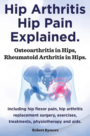 Hip Arthritis, Hip Pain Explained. Osteoarthritis in Hips, Rheumatoid Arthritis in Hips. Including Hip Arthritis Surgery, Hip Flexor Pain, Exercises, Rymore Robert
