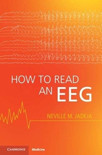 How to Read an EEG Neville M. Jadeja