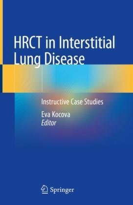 HRCT in Interstitial Lung Disease: Instructive Case Studies Springer Nature Switzerland AG
