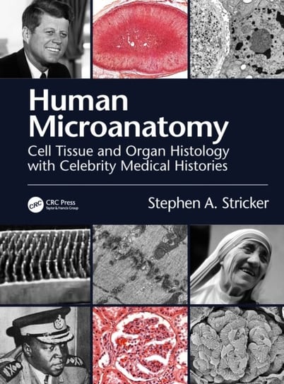 Human Microanatomy. Cell Tissue and Organ Histology with Celebrity Medical Histories Opracowanie zbiorowe