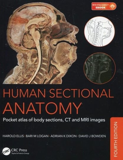 Human Sectional Anatomy: Pocket Atlas of Body Sections, CT and MRI Images Ellis Harold, Logan Bari M., Dixon Adrian K., Bowden David J.