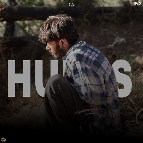 Hurts Ca, Crappy Dude & Akki Bhai