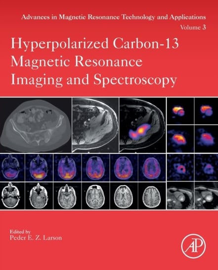 Hyperpolarized Carbon-13 Magnetic Resonance Imaging and Spectroscopy Opracowanie zbiorowe