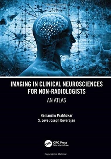 Imaging in Clinical Neurosciences for Non-radiologists: An Atlas Opracowanie zbiorowe