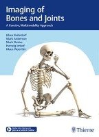 Imaging of Bones and Joints Bohndorf Klaus, Davies Mark, Imhof Herwig, Woertler Klaus, Anderson Mark