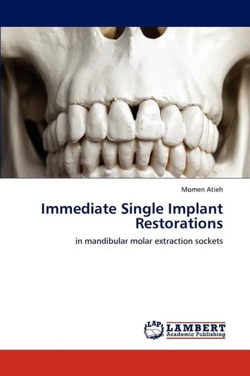 Immediate Single Implant Restorations Atieh Momen