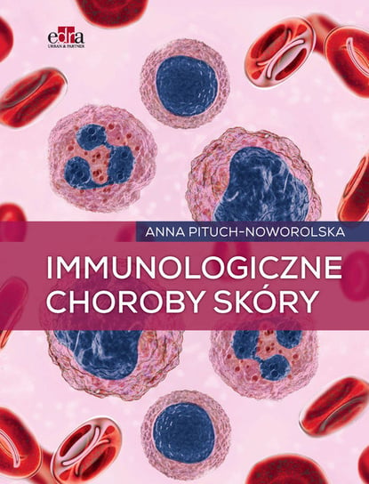 Immunologiczne choroby skóry A. Pituch-Noworolska