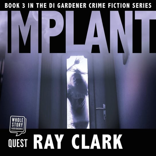 Implant Ray Clark