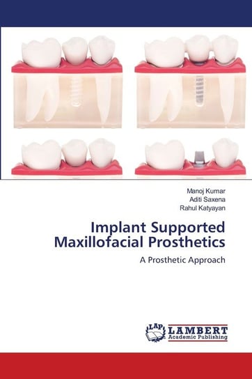 Implant Supported Maxillofacial Prosthetics Kumar Manoj