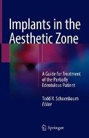 Implants in the Aesthetic Zone Springer-Verlag Gmbh, Springer International Publishing