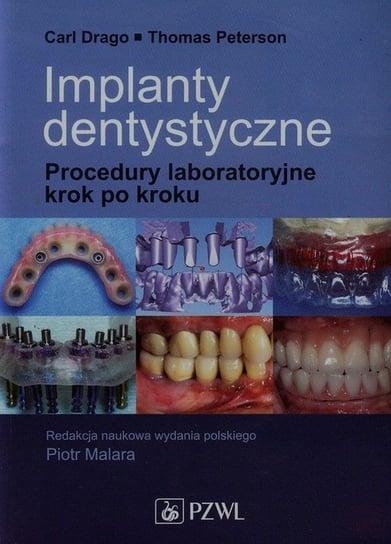 Implanty dentystyczne. Procedury laboratoryjne krok po kroku Drago Carl, Peterson Thomas