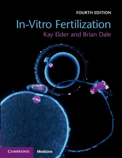 In-Vitro Fertilization Opracowanie zbiorowe