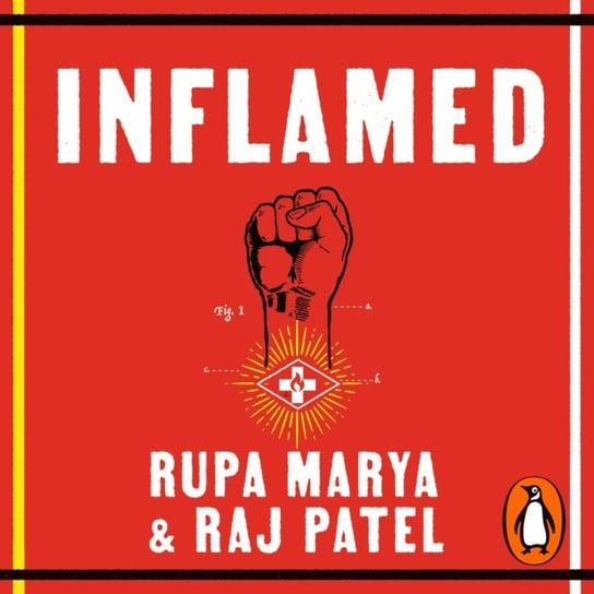 Inflamed Patel Raj, Marya Rupa